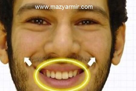 میکرو اکسپرشن